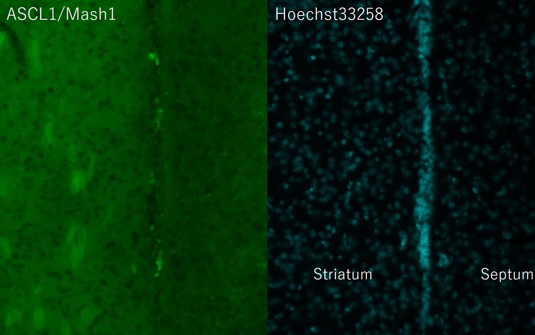 Mouse ASCL1/Mash1 Antibody AF2567
