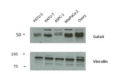 Human GATA‑4 Antibody AF2606