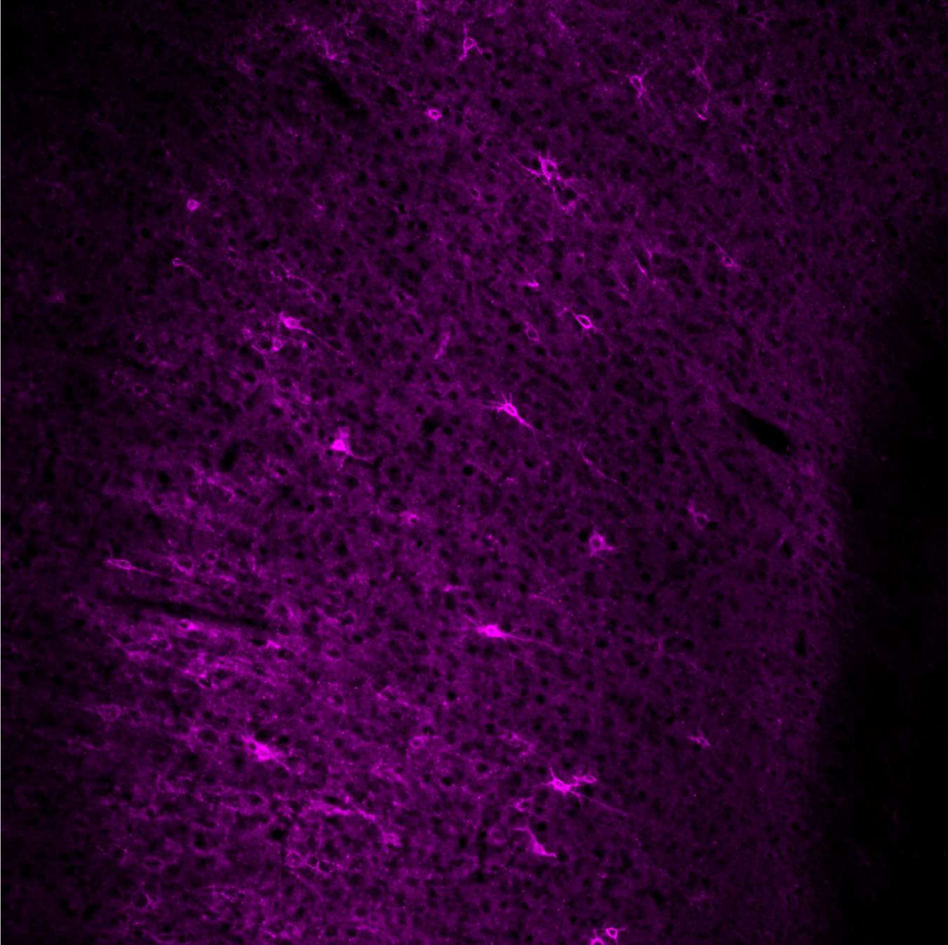 Human HAPLN1 Antibody AF2608