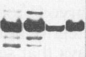 Mouse GFR alpha ‑3/GDNF R alpha ‑3 Antibody AF2645