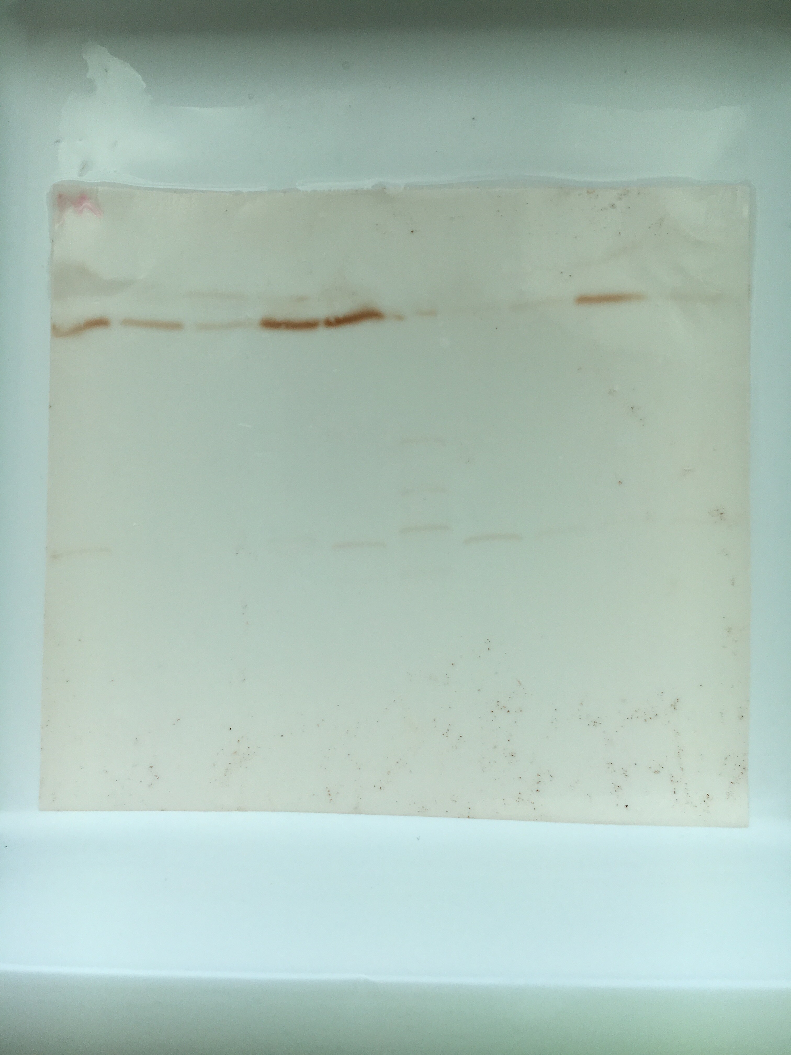 Human/Rat Angiogenin Antibody AF265