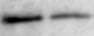 Human SHBG Antibody AF2656