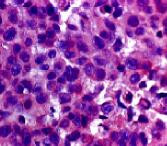 Human SHBG Antibody AF2656