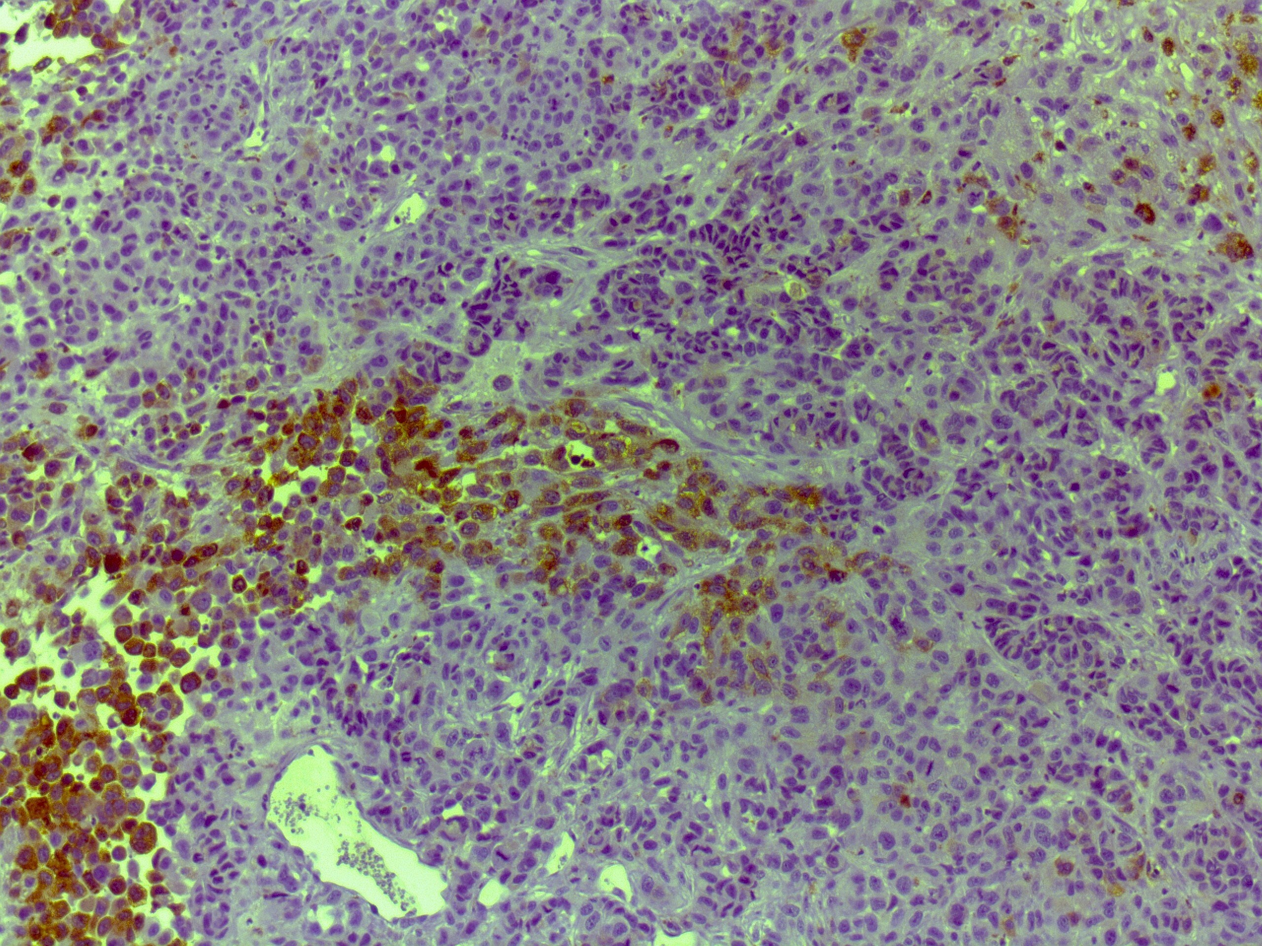 Human/Rat Angiogenin Antibody AF265