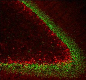 Human Prox1 Antibody AF2727