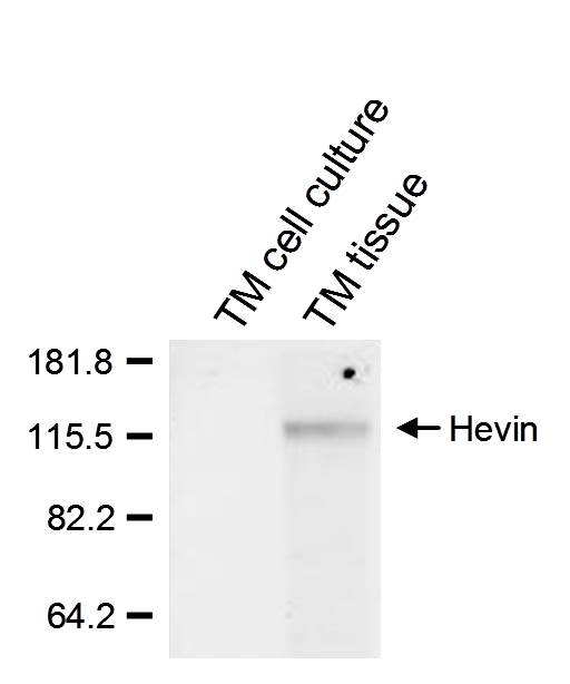 Human SPARC‑like 1/SPARCL1 Antibody AF2728
