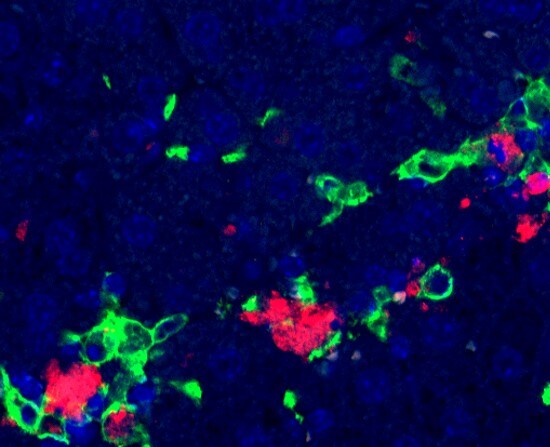 Mouse CLEC4F/CLECSF13 Antibody AF2784