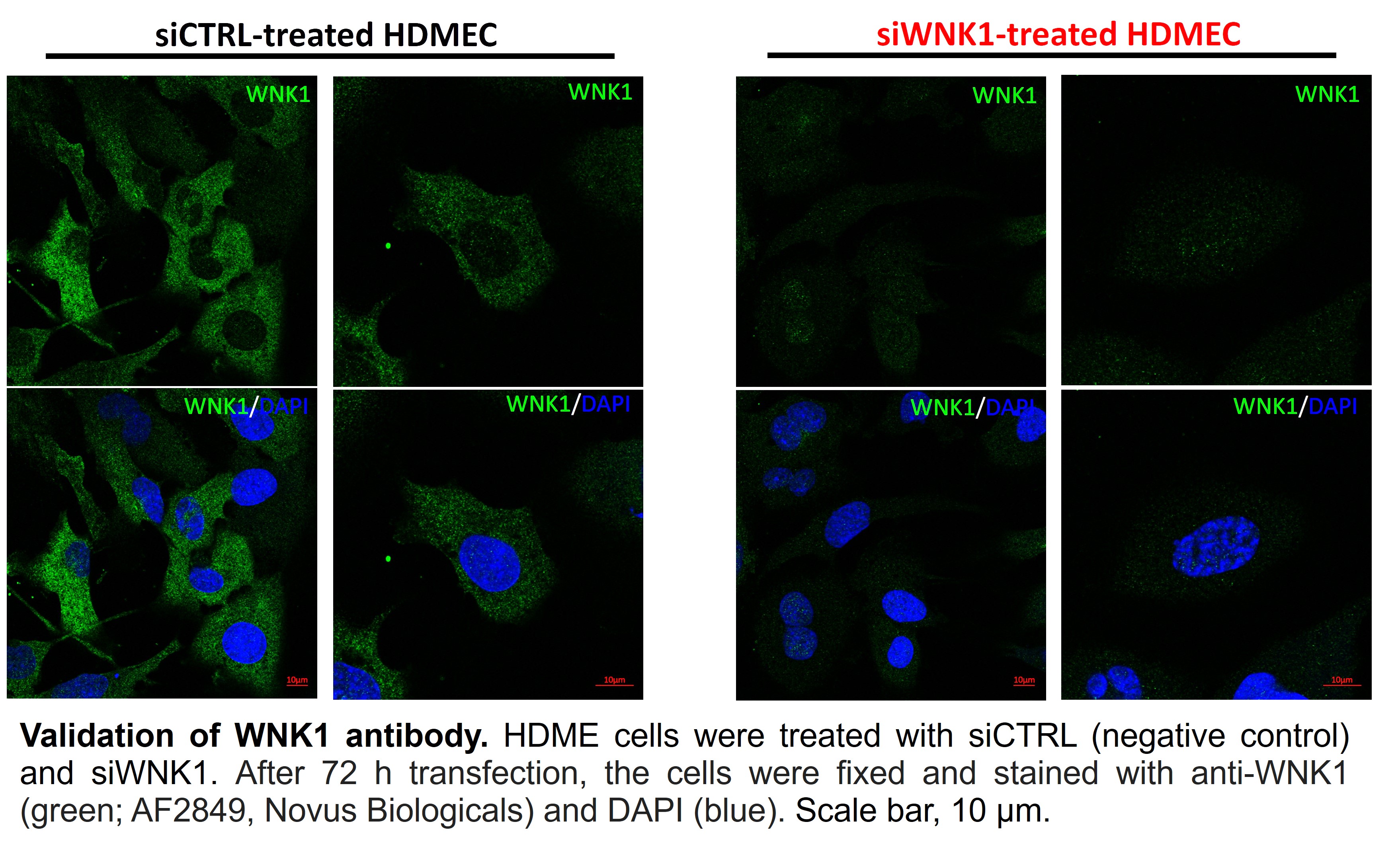 Mouse/Rat WNK1 Antibody AF2849