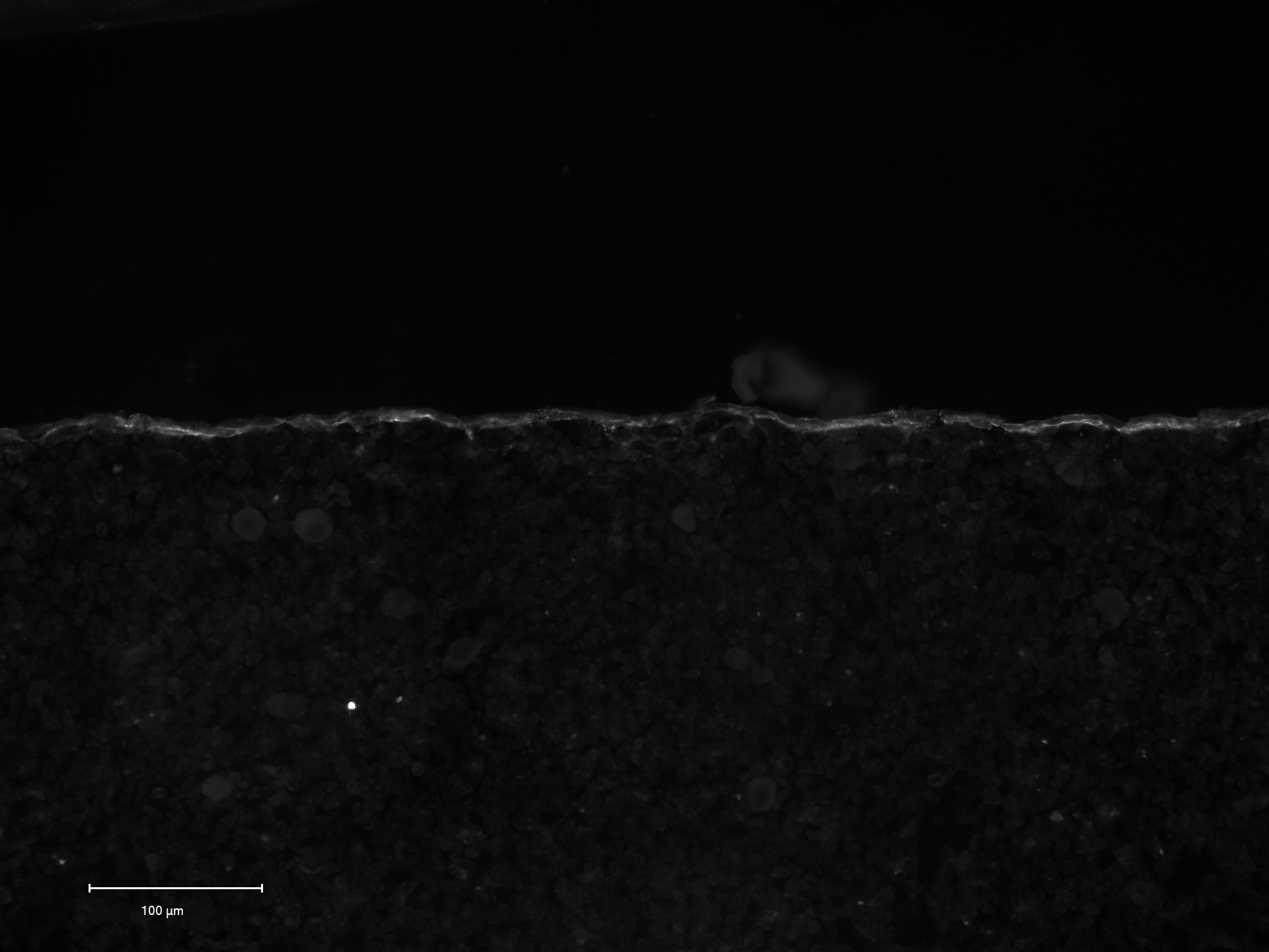 Human/Mouse Alkaline Phosphatase/ALPL Antibody AF2909