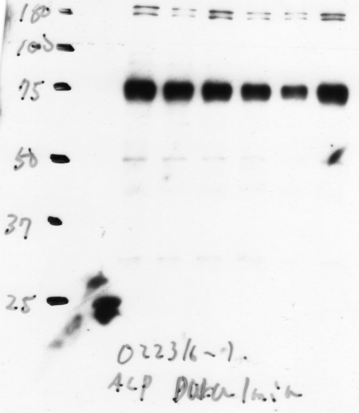 Mouse Alkaline Phosphatase/ALPL Antibody AF2910