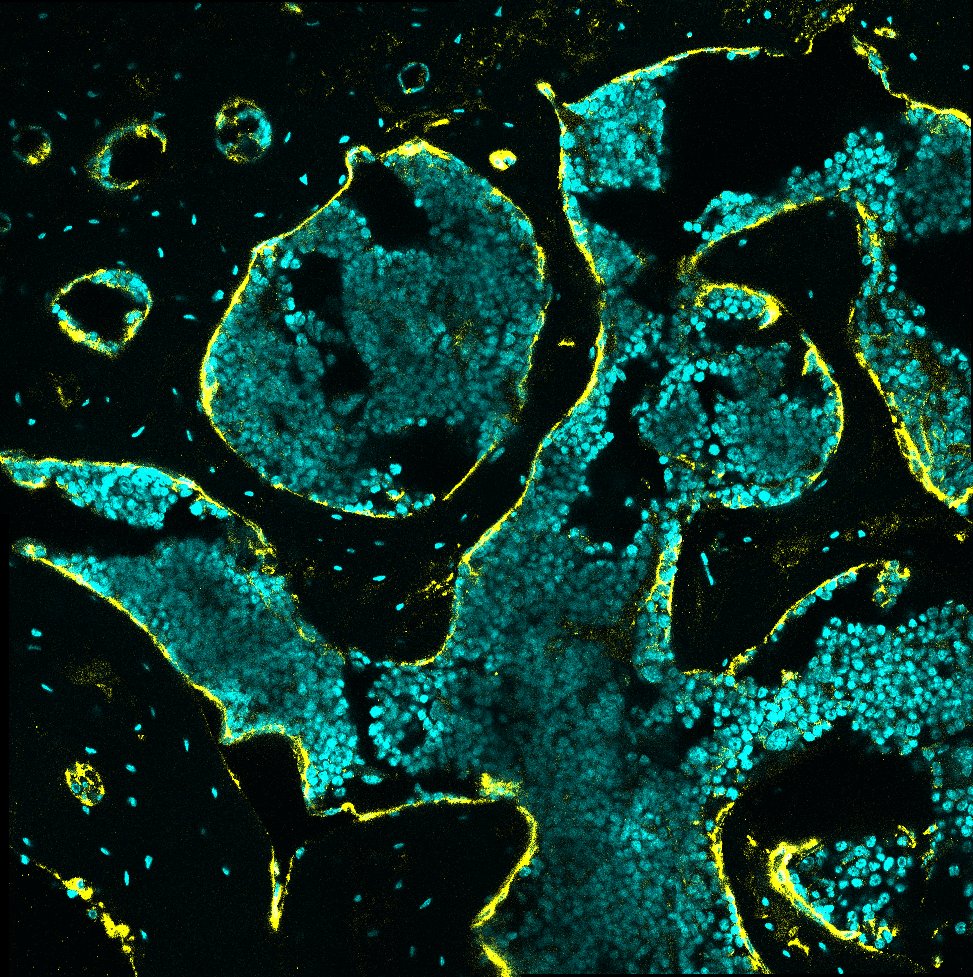 Mouse Alkaline Phosphatase/ALPL Antibody AF2910