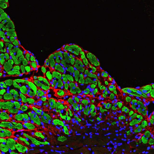 Mouse Periostin/OSF‑2 Isoform 2 Antibody AF2955