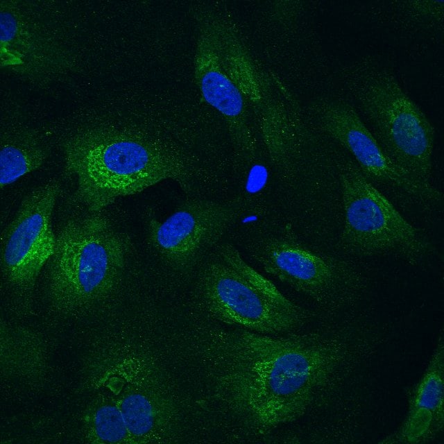 Mouse Periostin/OSF‑2 Isoform 2 Antibody AF2955