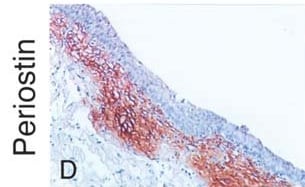 Mouse Periostin/OSF‑2 Isoform 2 Antibody AF2955