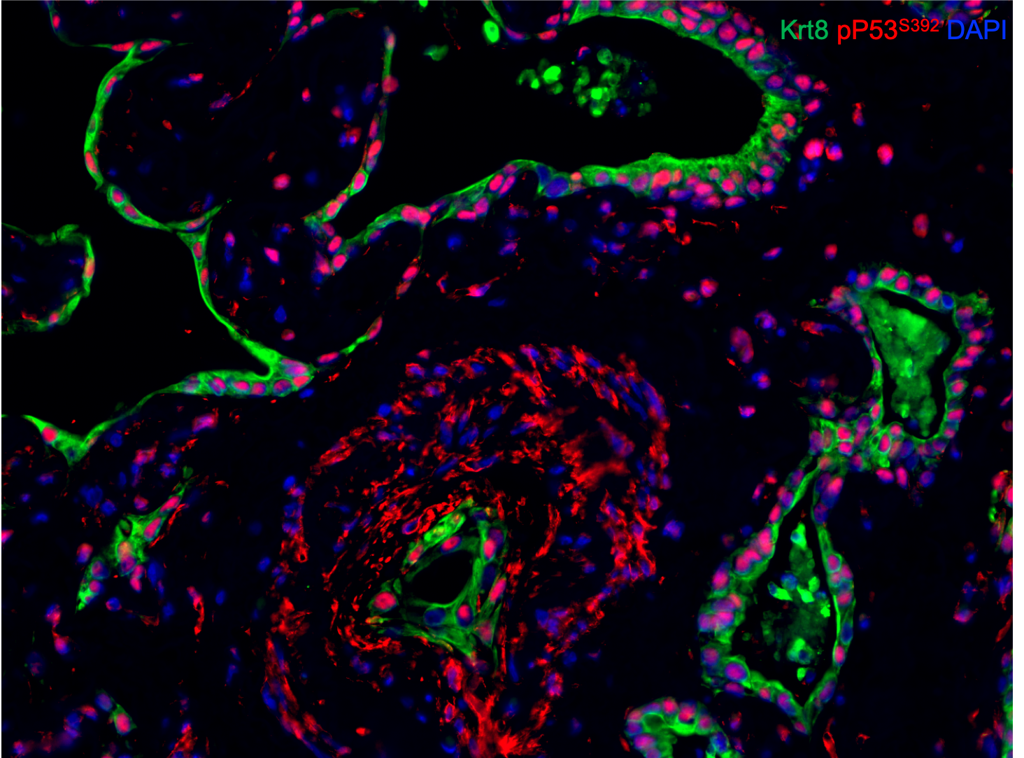 Human Phospho-p53 (S392) Antibody AF2996