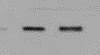 Human TGF‑ beta  RI/ALK‑5 Antibody AF3025