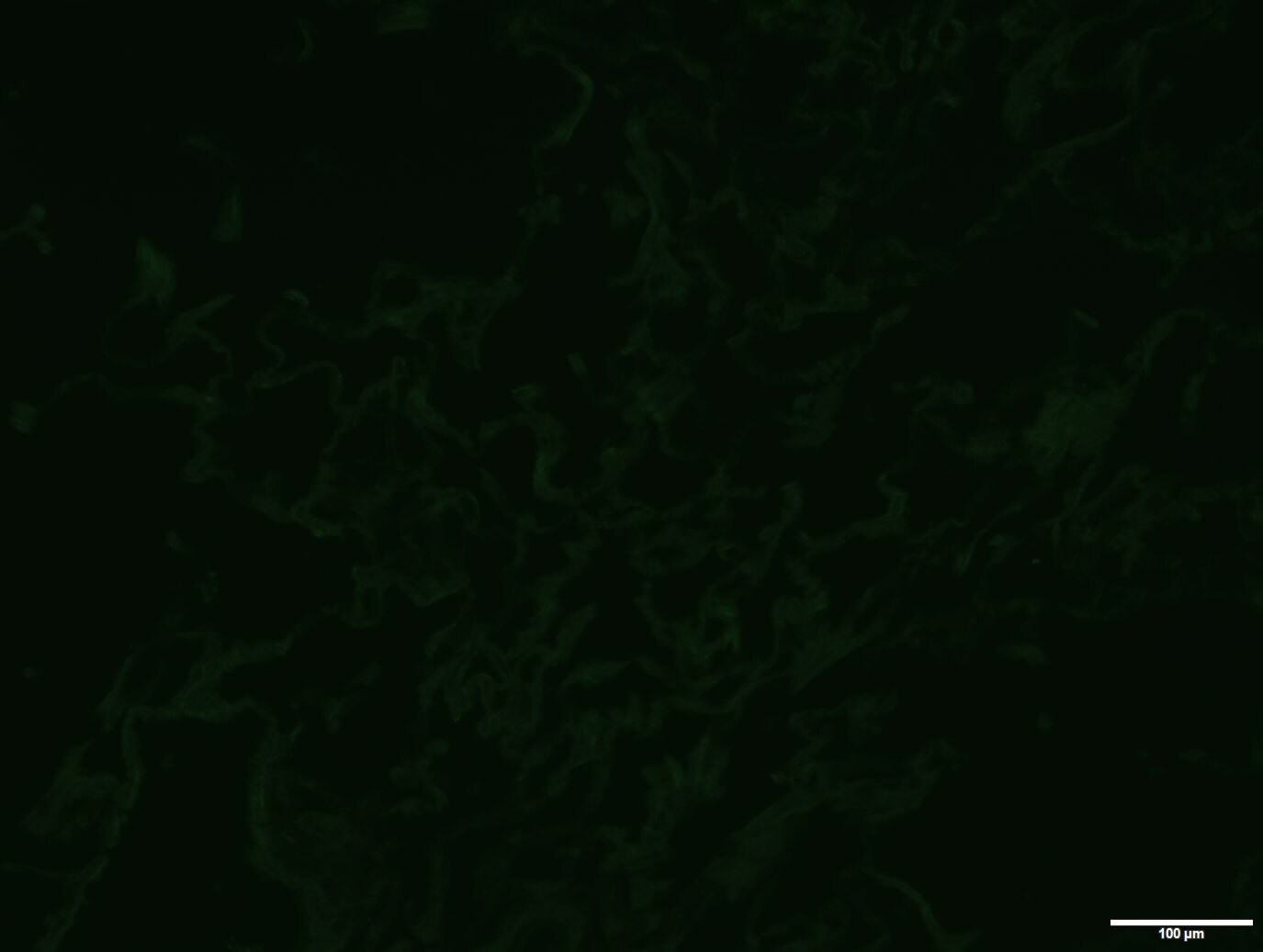 Human IL-32 Antibody AF3040