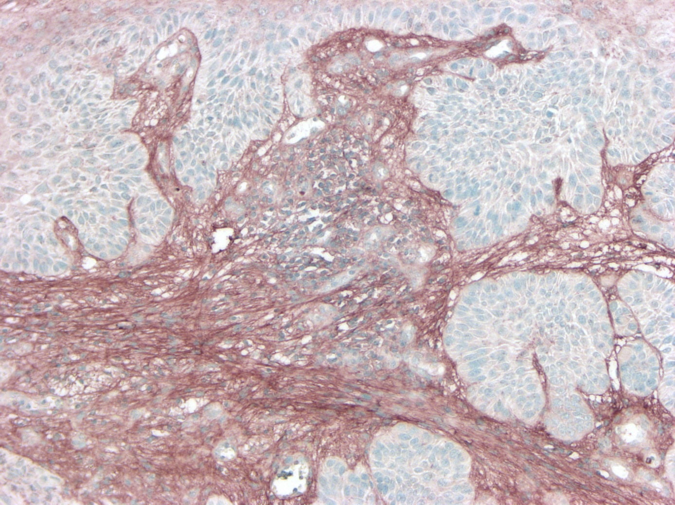 Human Versican Isoform V0 Antibody AF3054