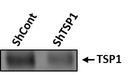 Human Thrombospondin‑1 Antibody AF3074