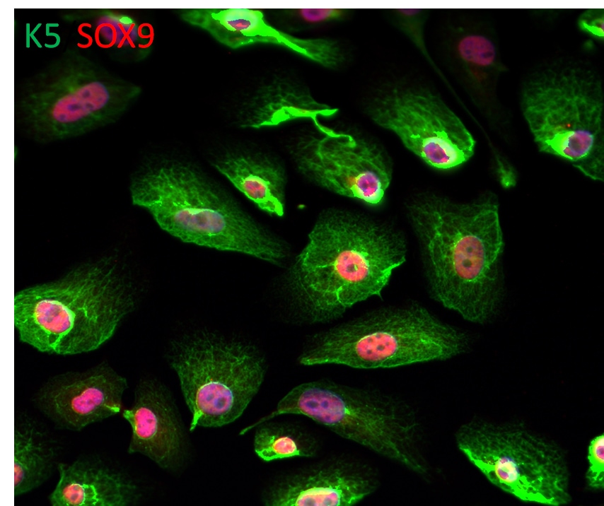 Human SOX9 Antibody AF3075