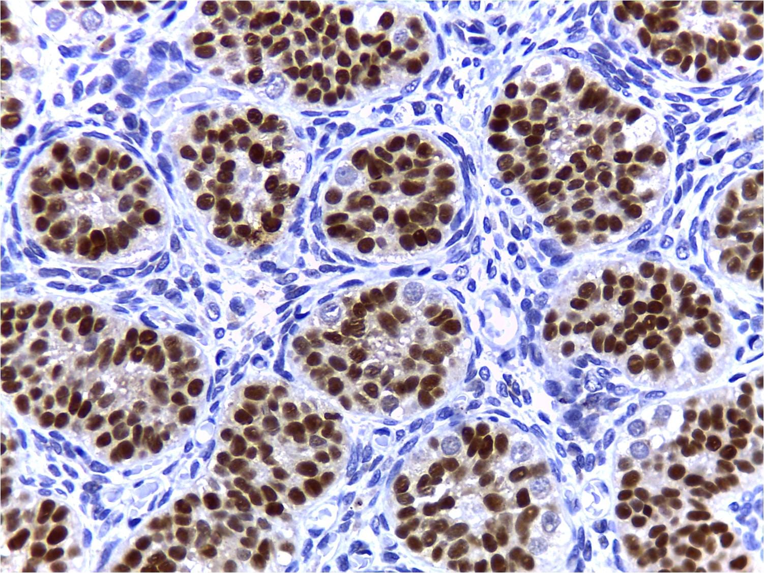 Human SOX9 Antibody AF3075