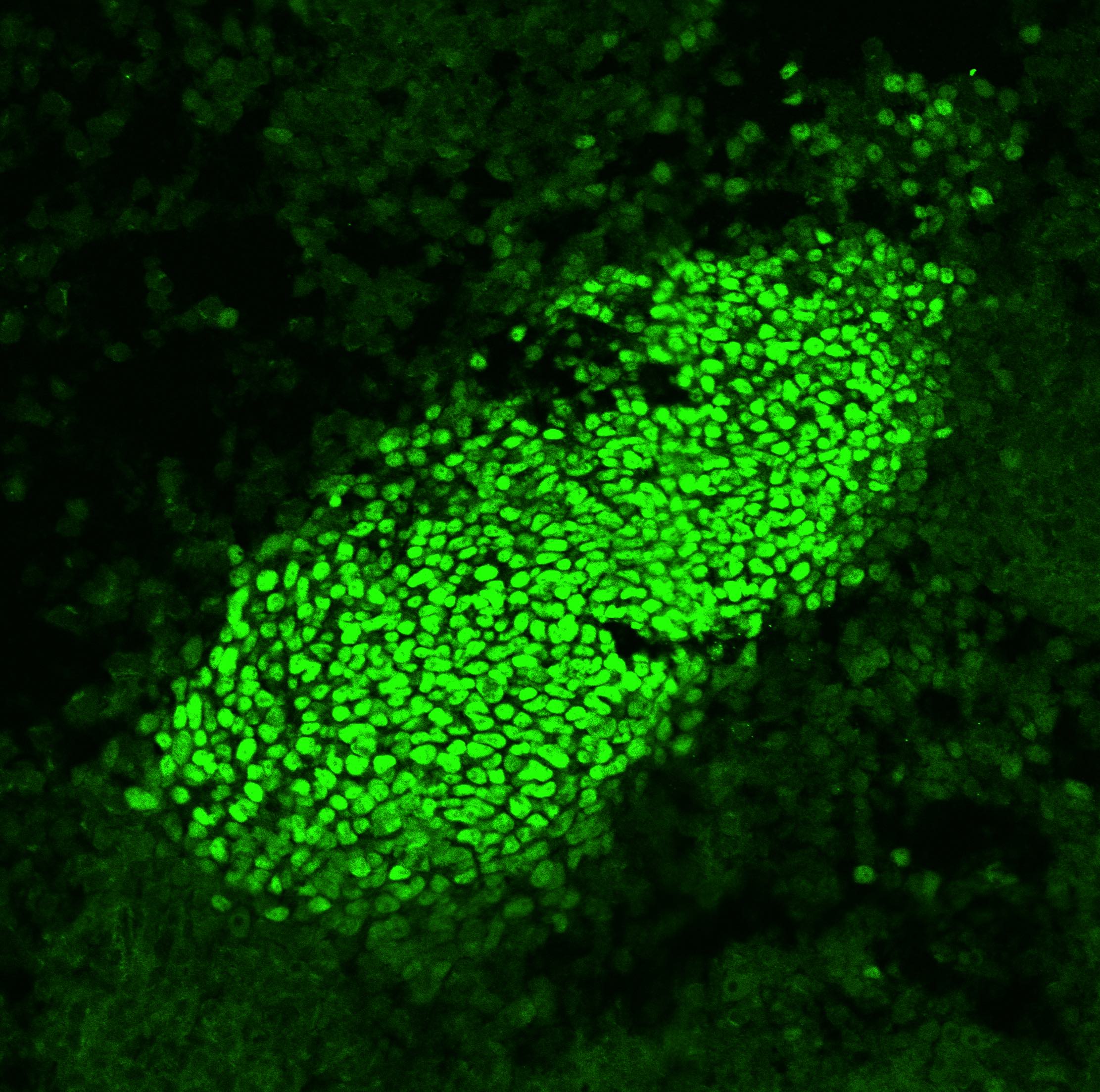 Human SOX9 Antibody AF3075