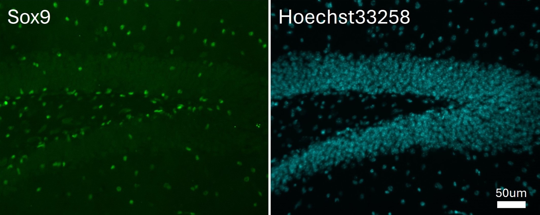 Human SOX9 Antibody AF3075