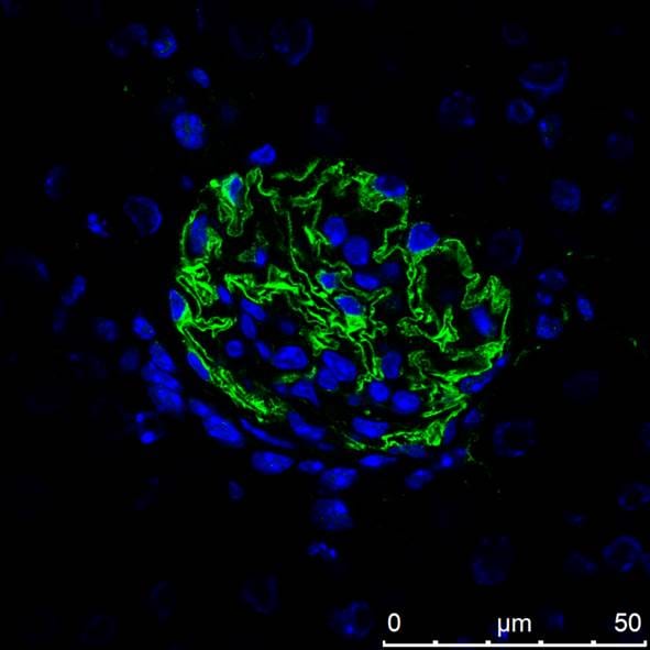 Mouse Nephrin Antibody AF3159