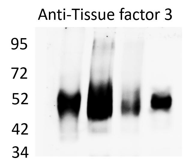 Mouse Coagulation Factor III/Tissue Factor Antibody AF3178