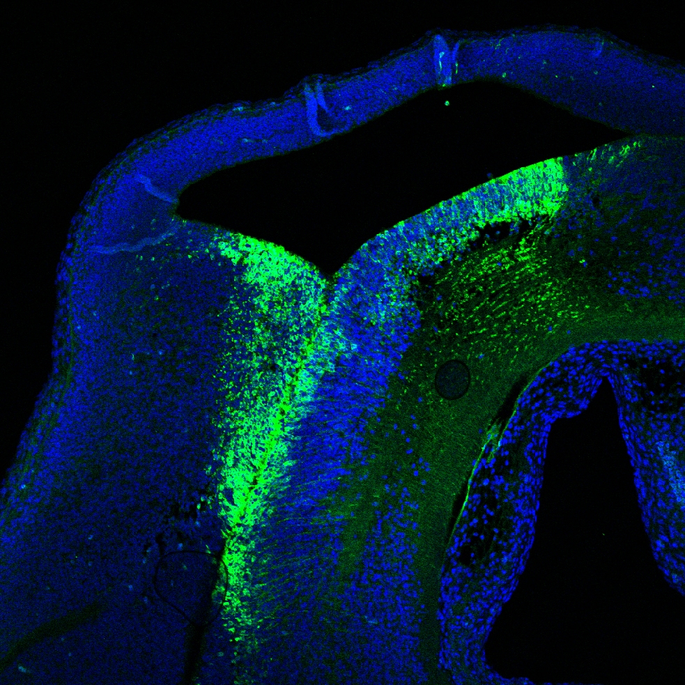 Human VEGFR1/Flt-1 Antibody AF321