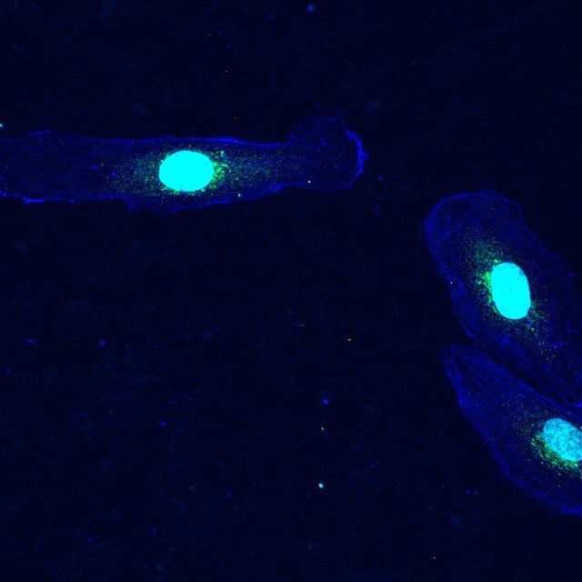Human VEGFR1/Flt-1 Antibody AF321