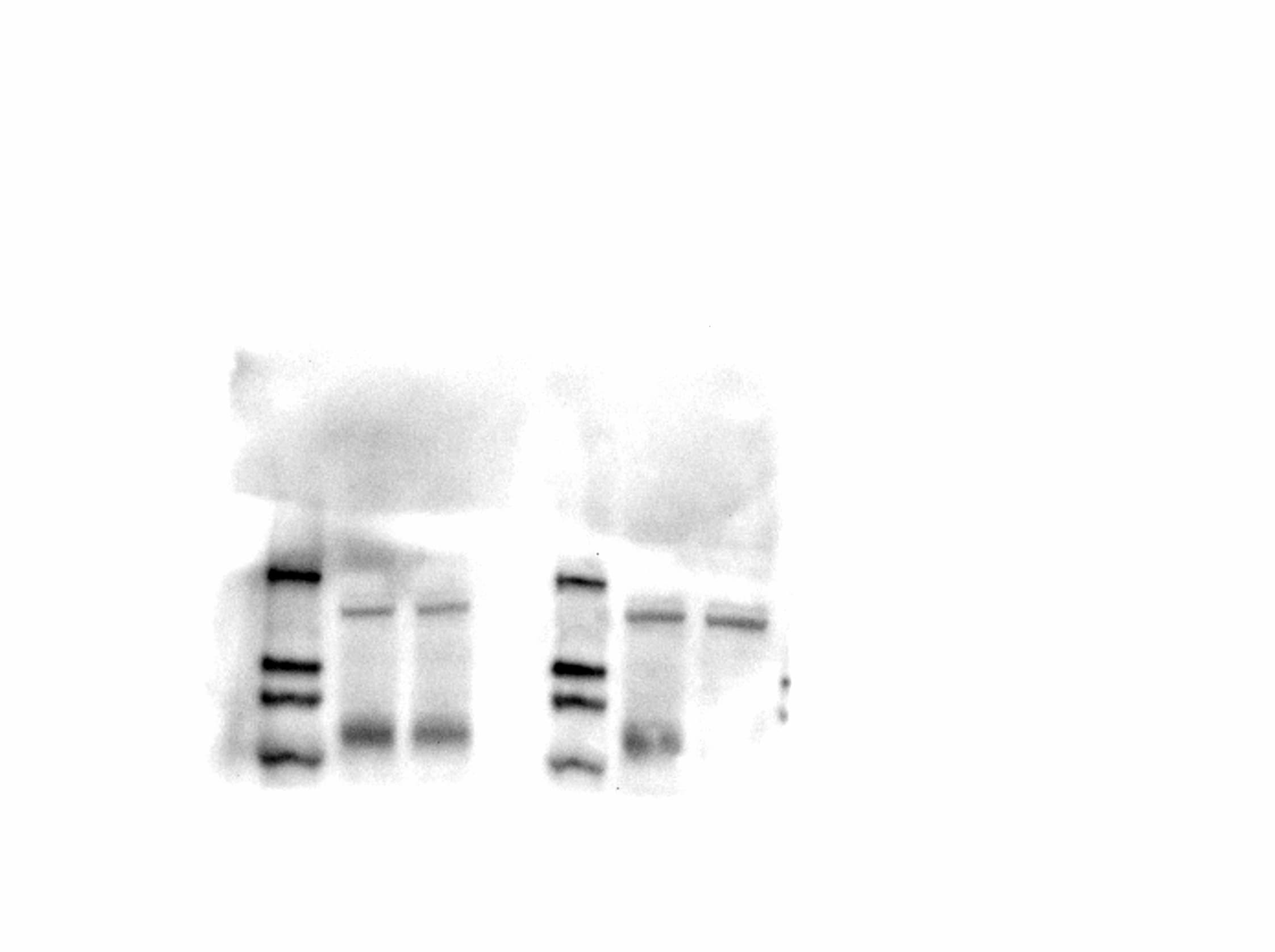 Human VEGFR1/Flt-1 Antibody AF321