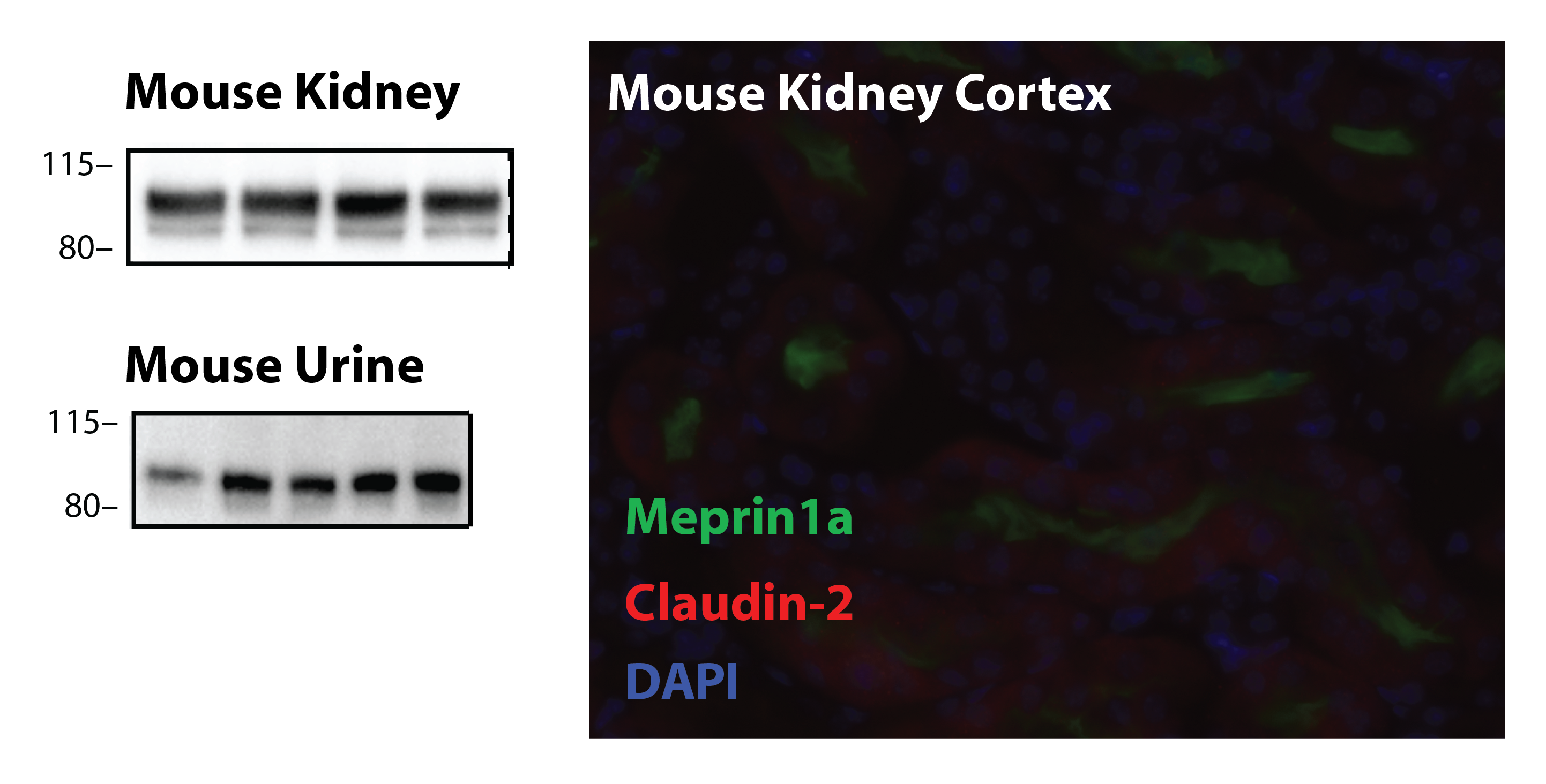 Human Meprin  alpha  Subunit/MEP1A Antibody AF3220