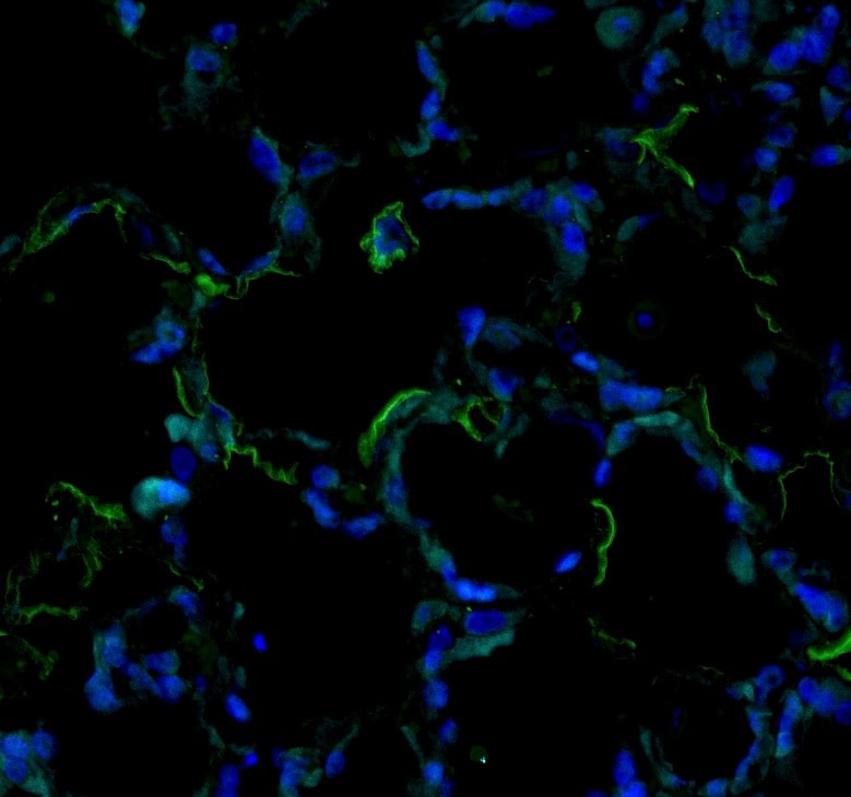 Human/Mouse Semaphorin 3E Antibody AF3239