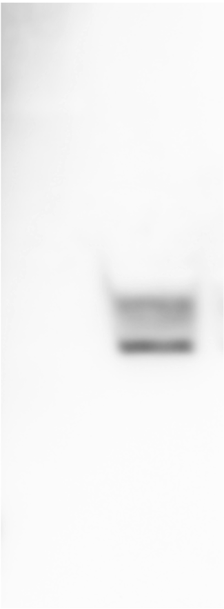 Human TREML2/TLT‑2 Antibody AF3259