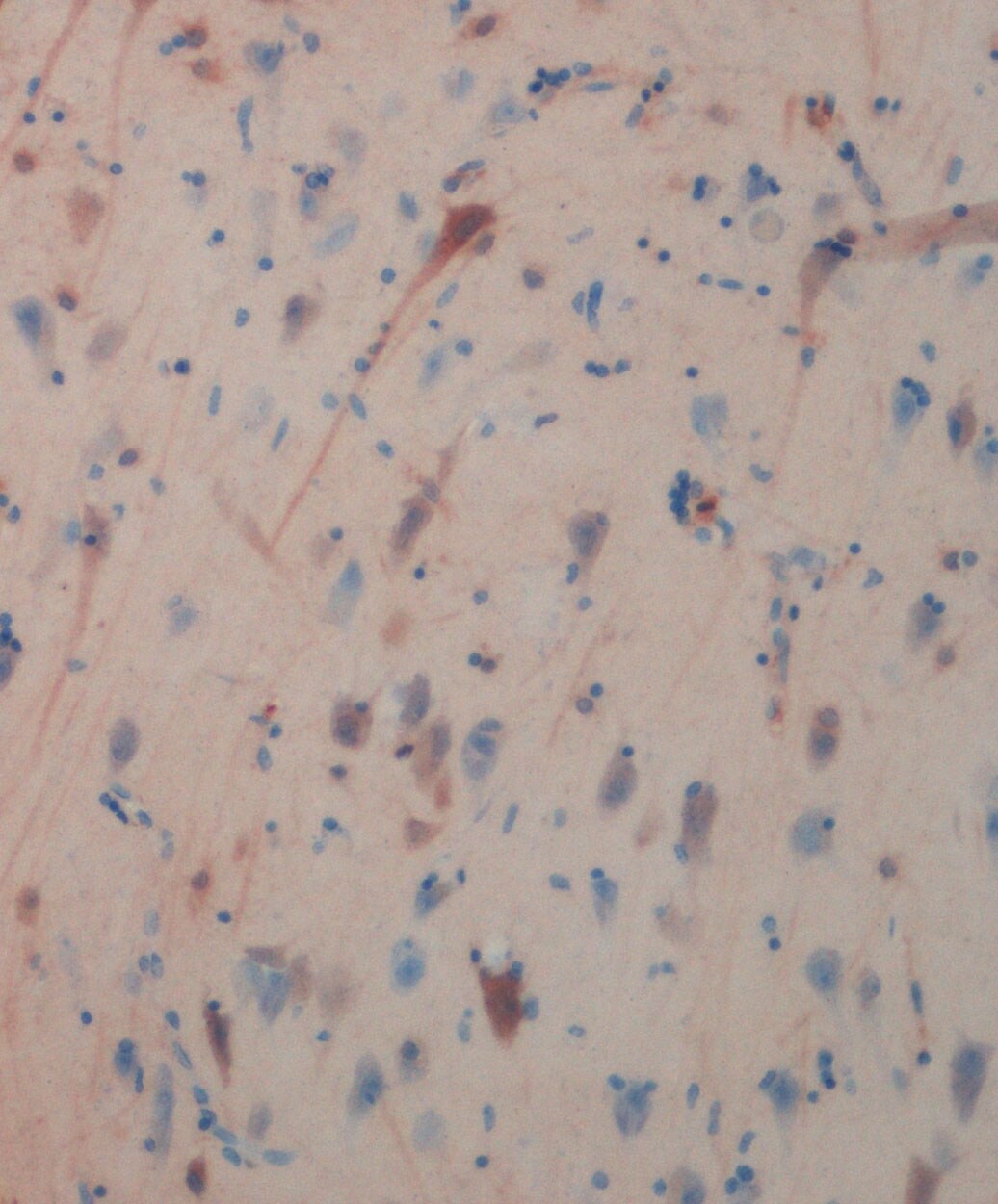 Human TRAF‑3 Isoform 2 Antibody AF3278