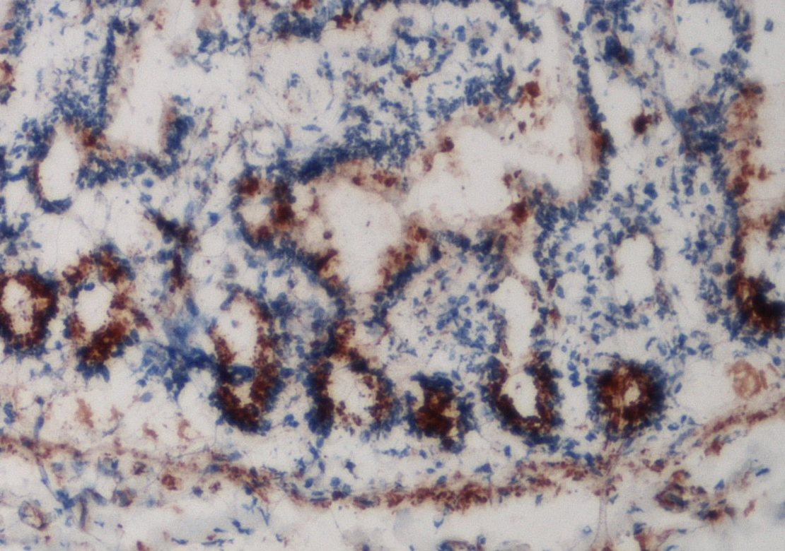 Human TRAF‑6 Antibody AF3284