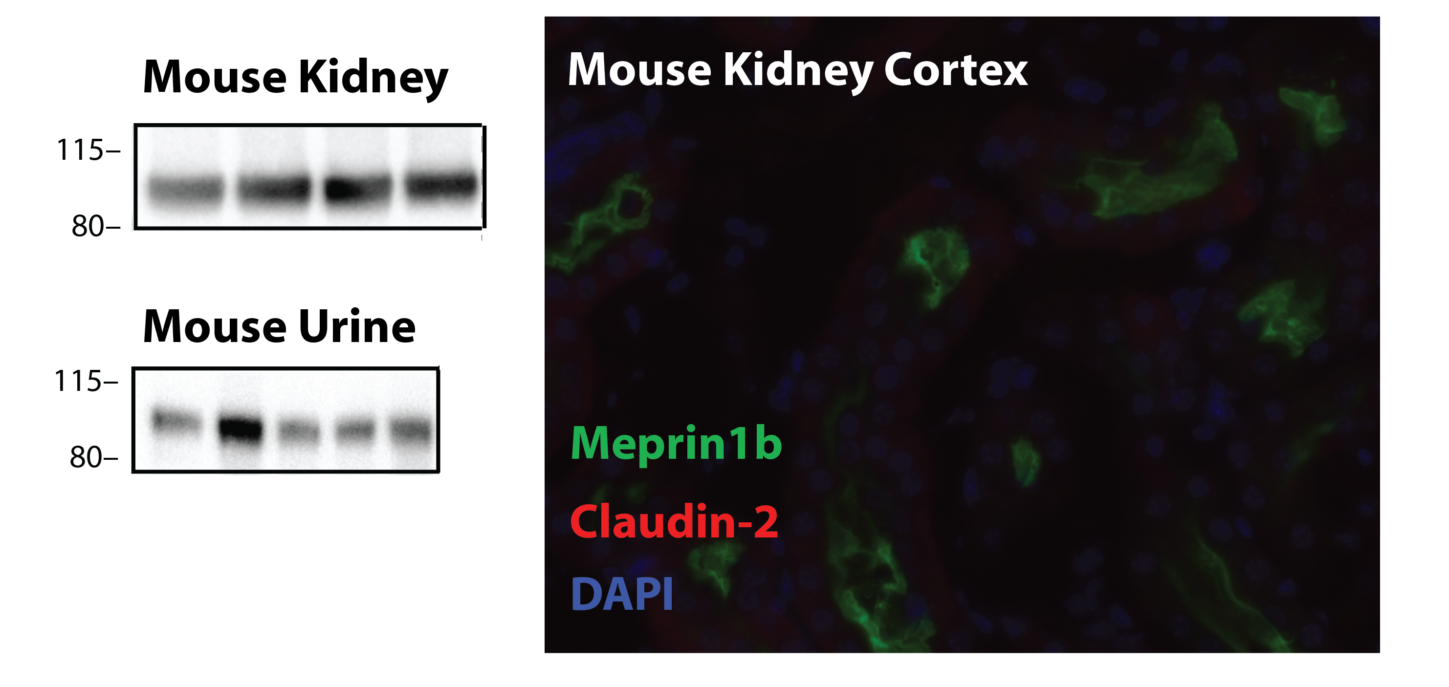 Mouse Meprin  beta  Subunit/MEP1B Antibody AF3300