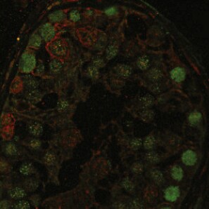 Human CD117/c-kit Antibody AF332