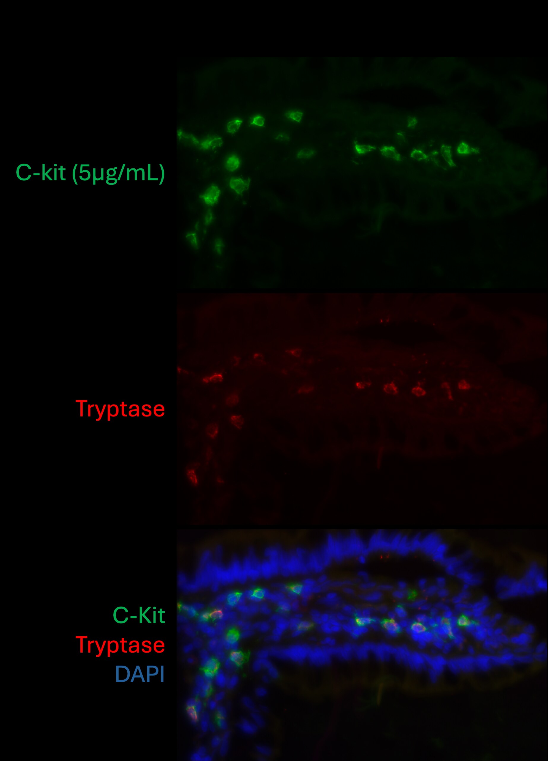 Human CD117/c-kit Antibody AF332