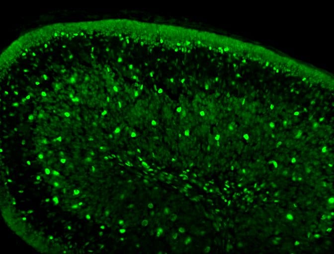 Human Pax2 Antibody AF3364