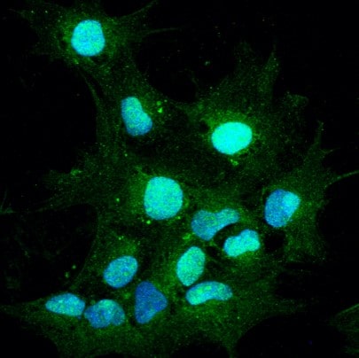 Human Pax2 Antibody AF3364
