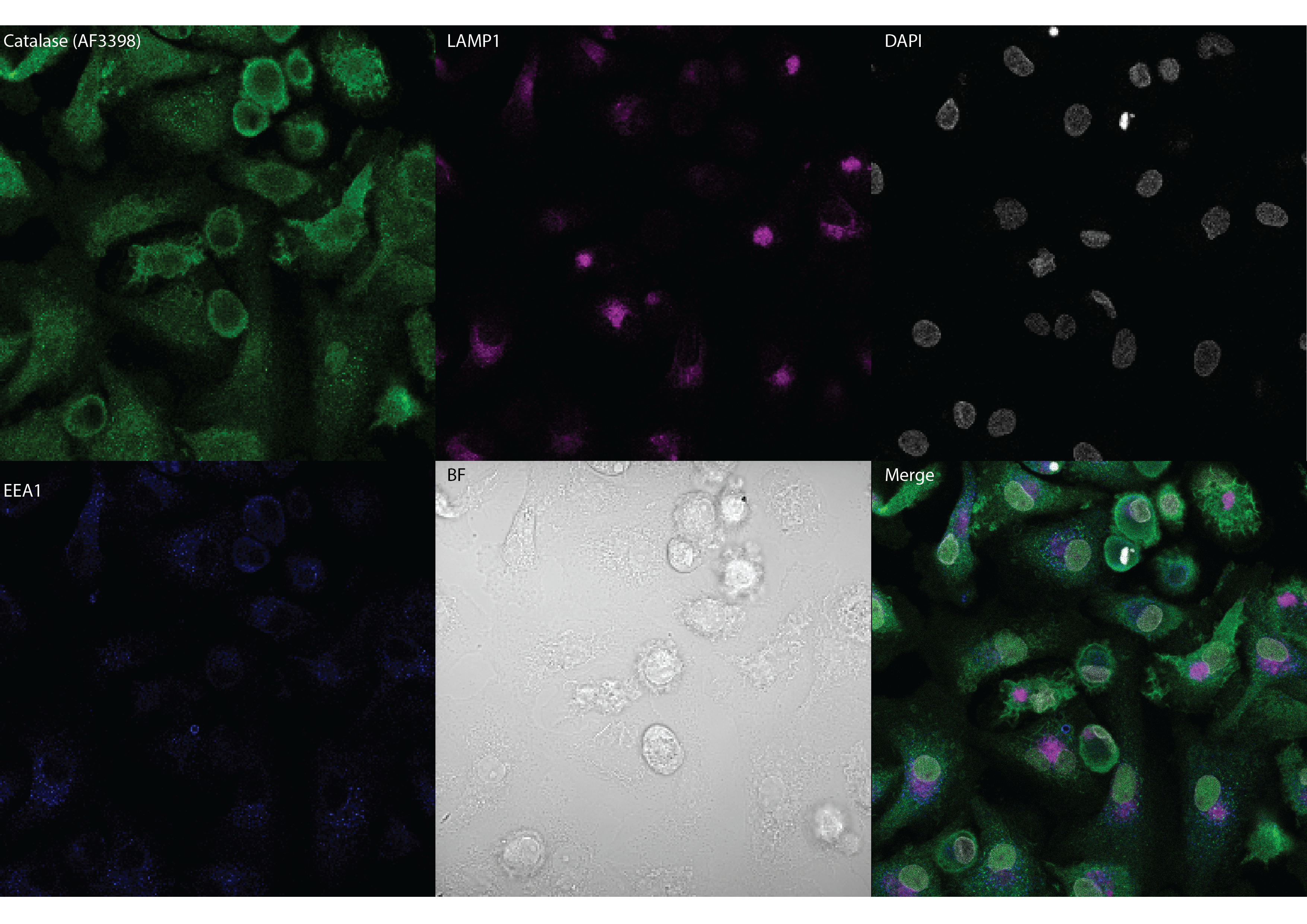 Human/Mouse/Rat Catalase Antibody AF3398