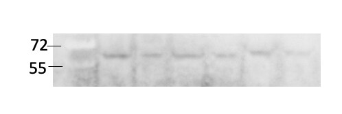 Human/Mouse/Rat Catalase Antibody AF3398