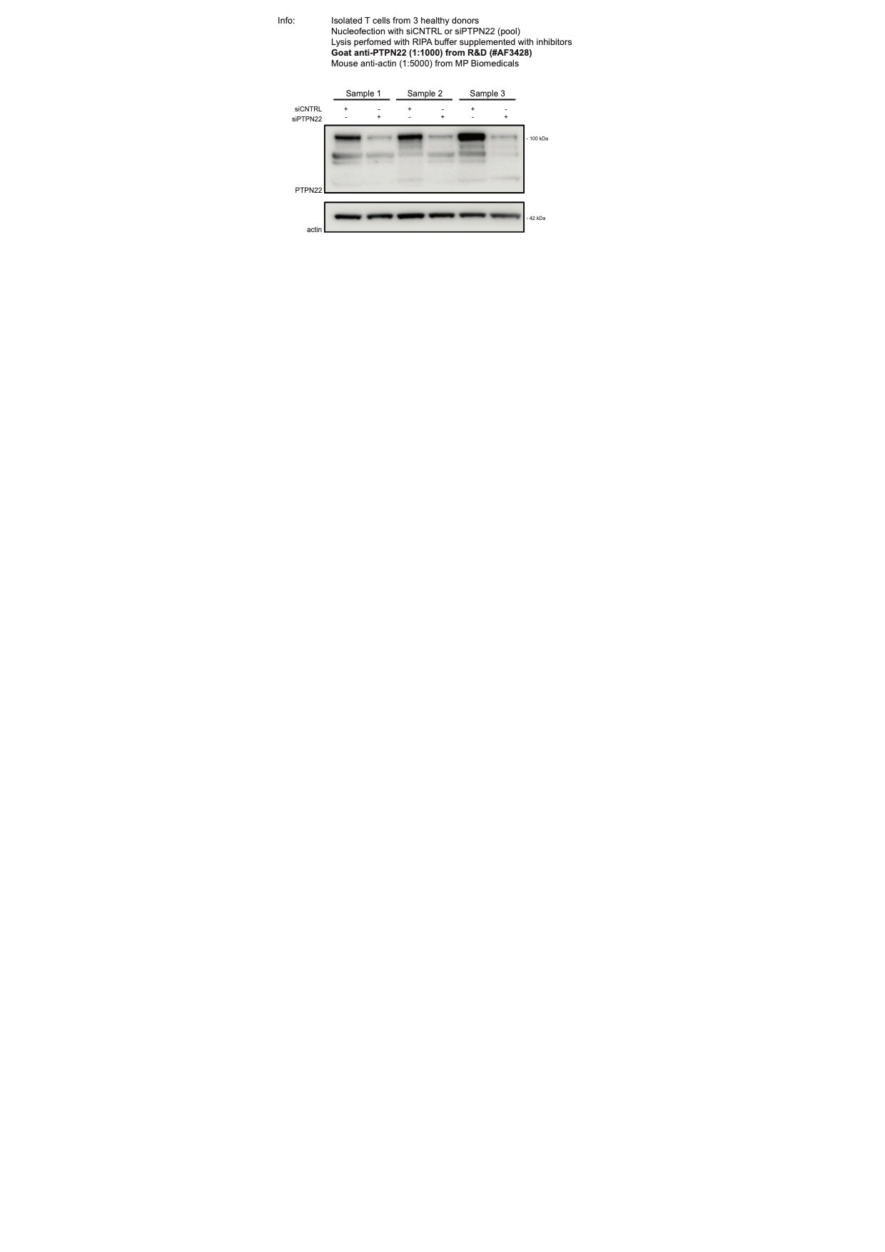 Human Lyp Antibody AF3428