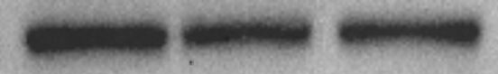 Mouse ACE‑2 Antibody AF3437