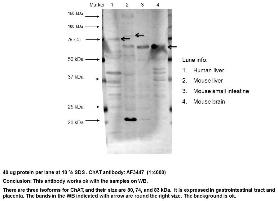 Human Choline Acetyltransferase/ChAT Antibody AF3447