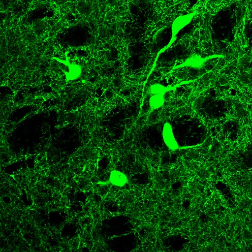 Human Choline Acetyltransferase/ChAT Antibody AF3447