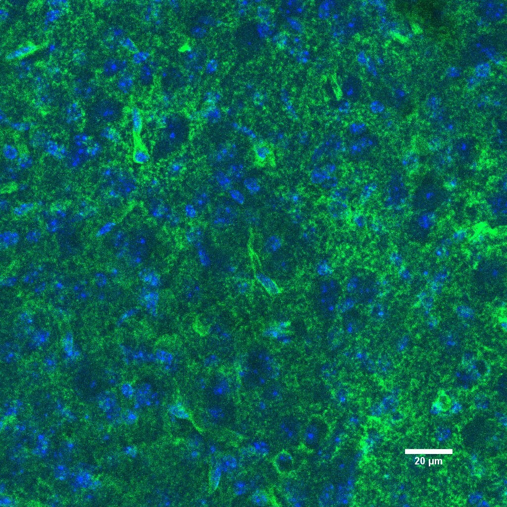 Human/Mouse GLI‑1 Antibody AF3455