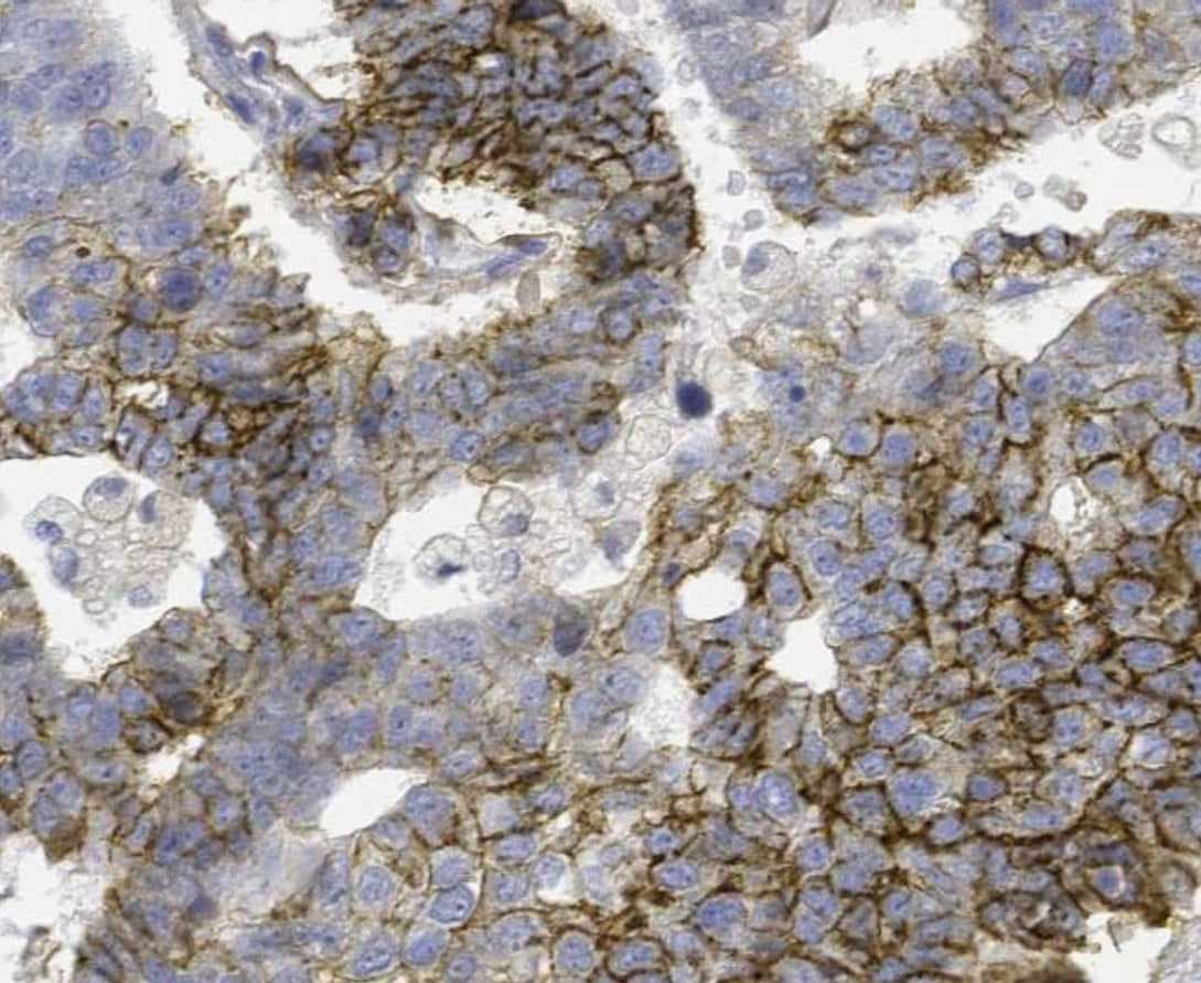 Human FGF‑10 Antibody AF345